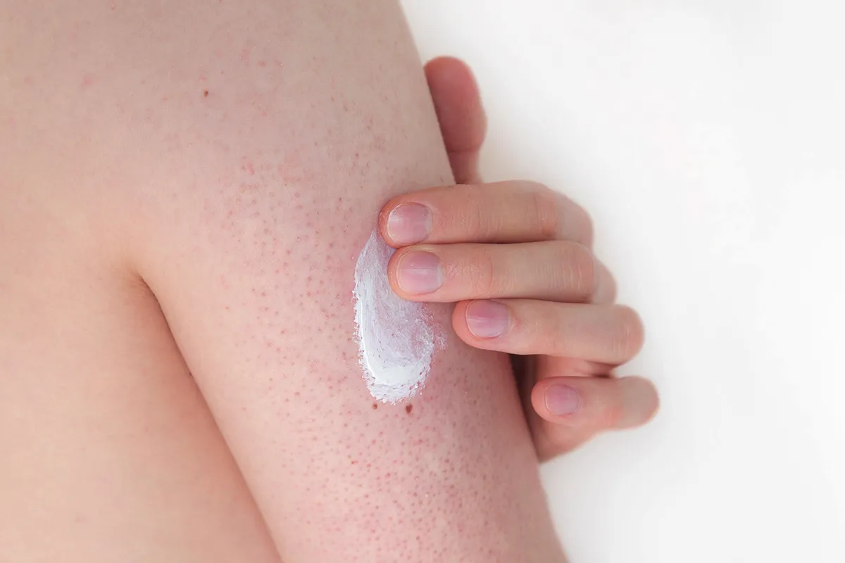 Creme unter Fingern auf einem Oberarm