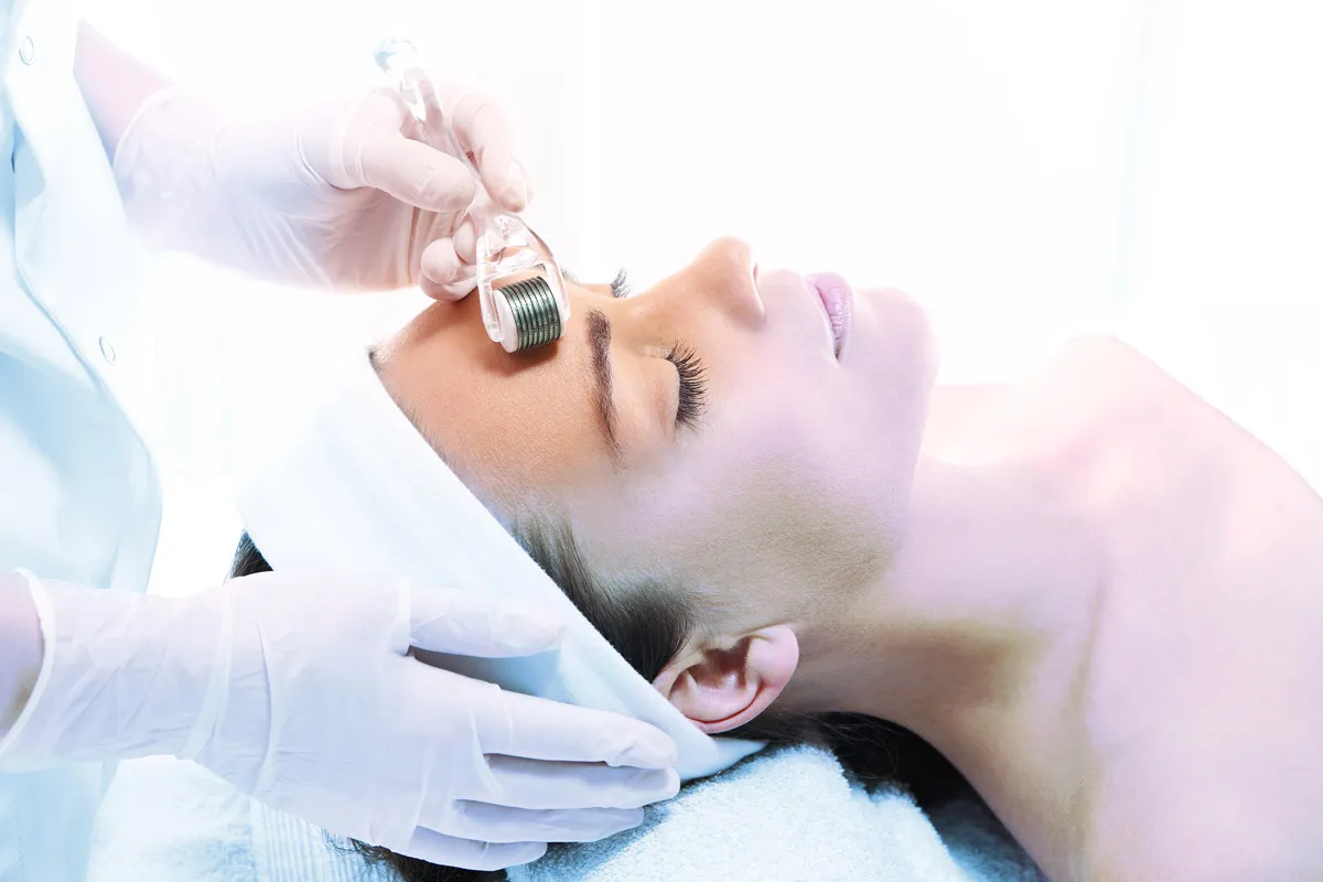 Mirconeedling Mirconeedling im Gesicht einer Frau