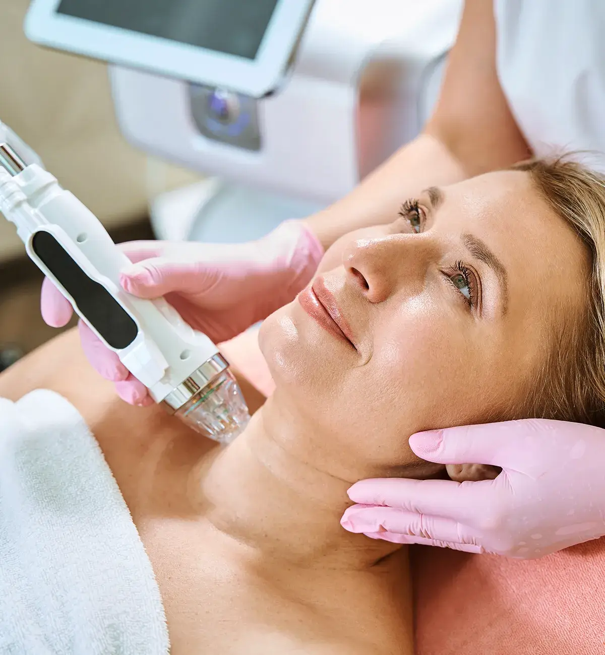 Microneedling Schmerzeinflussfaktoren Hals empfindlich Microneedling am Hals einer liegenden weiblichen Person