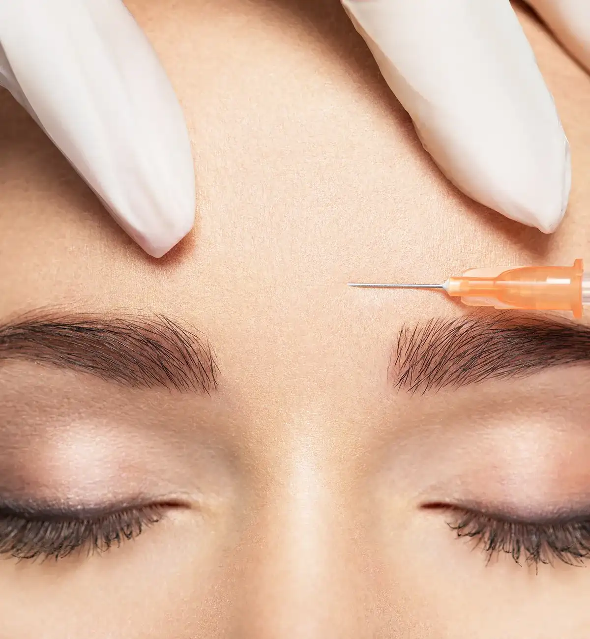 Schmerzfaktoren bei Unterspritzungen Nachaufnahme der Stirnpatie einer weiblichen Person mit Spritze zwischen den Augenbrauen