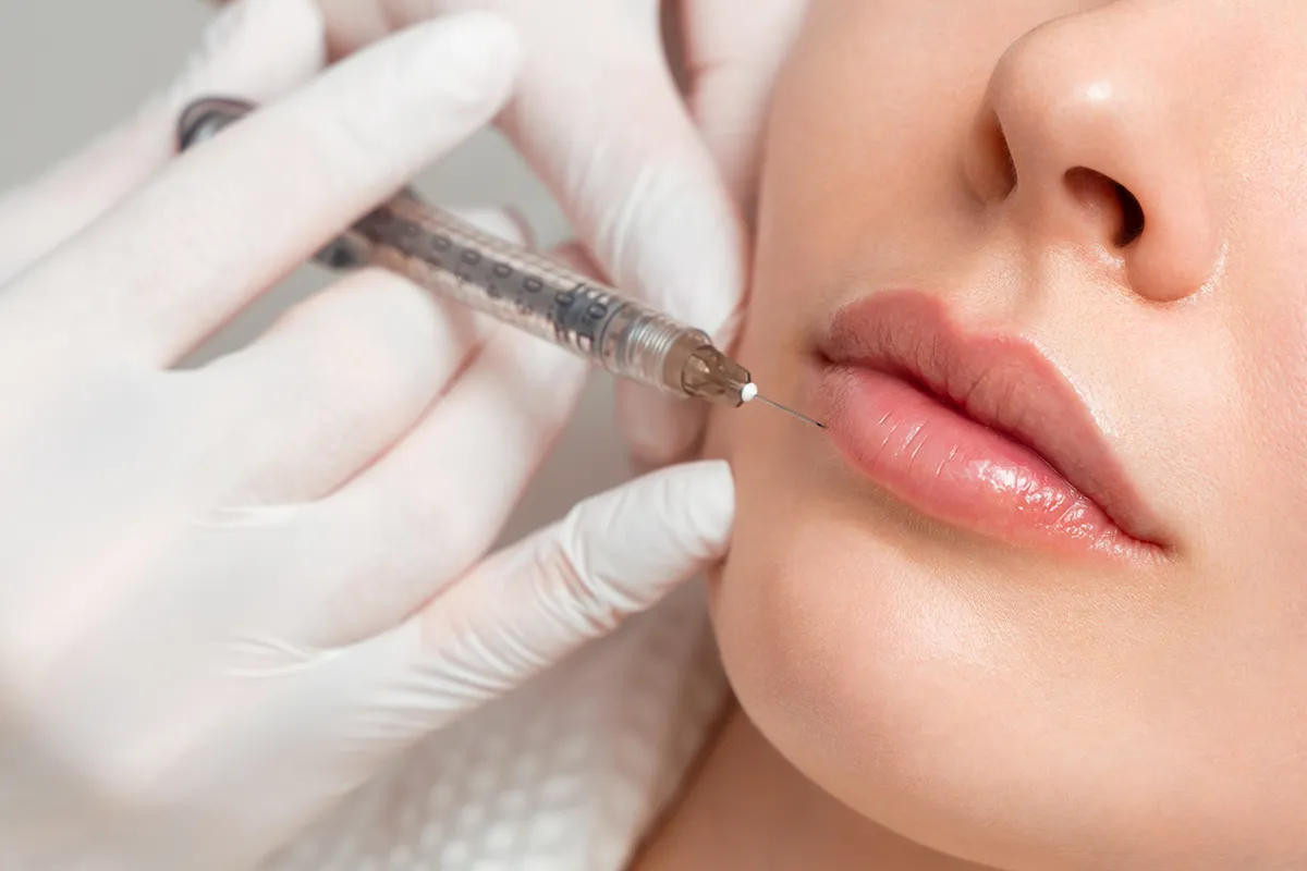 Unterspritzungen Schmerzlinderung Lidogalen Creme Nahaufnahme Lippenunterspritzung an einer weiblichen Person